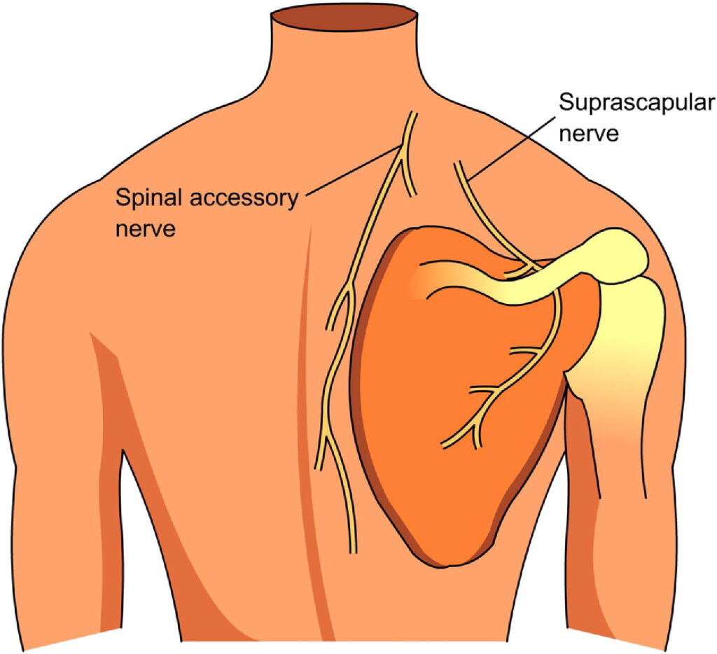 Dorsal Scapular Nerve Entrapment A Guide To Symptoms Diagnosis And