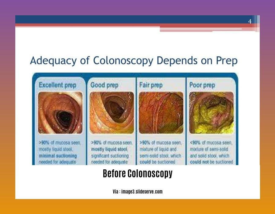 Cleaning out colon before colonoscopy 2